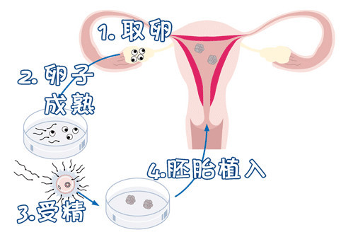 妇科